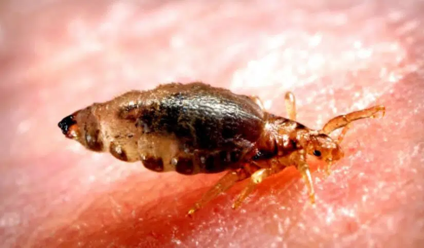 Do I have lice or a bed bug infestation salt lake city